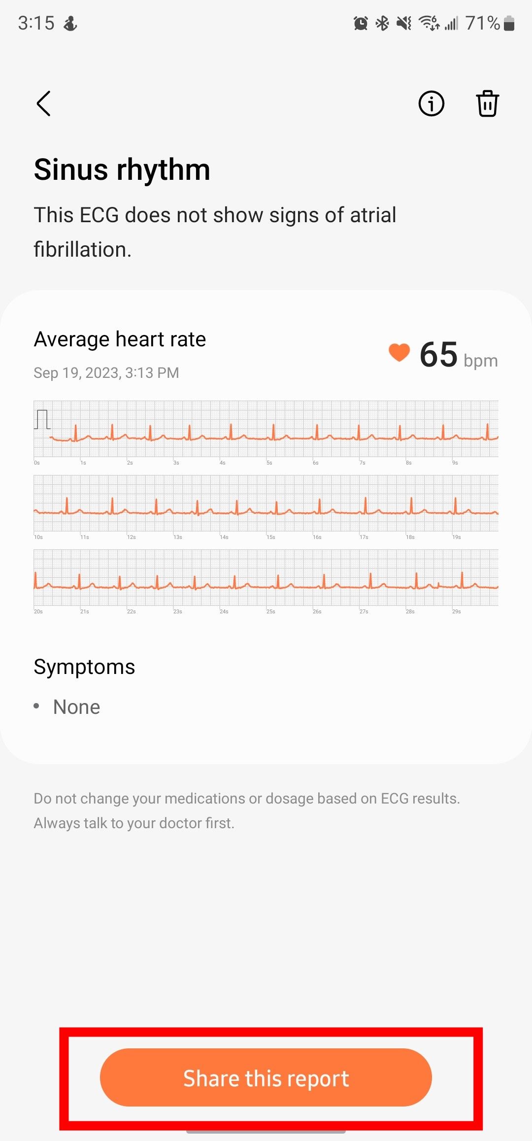 Resultados de ECG no aplicativo móvel Samsung Health Monitor, com a opção ‘Compartilhar este relatório’ destacada.