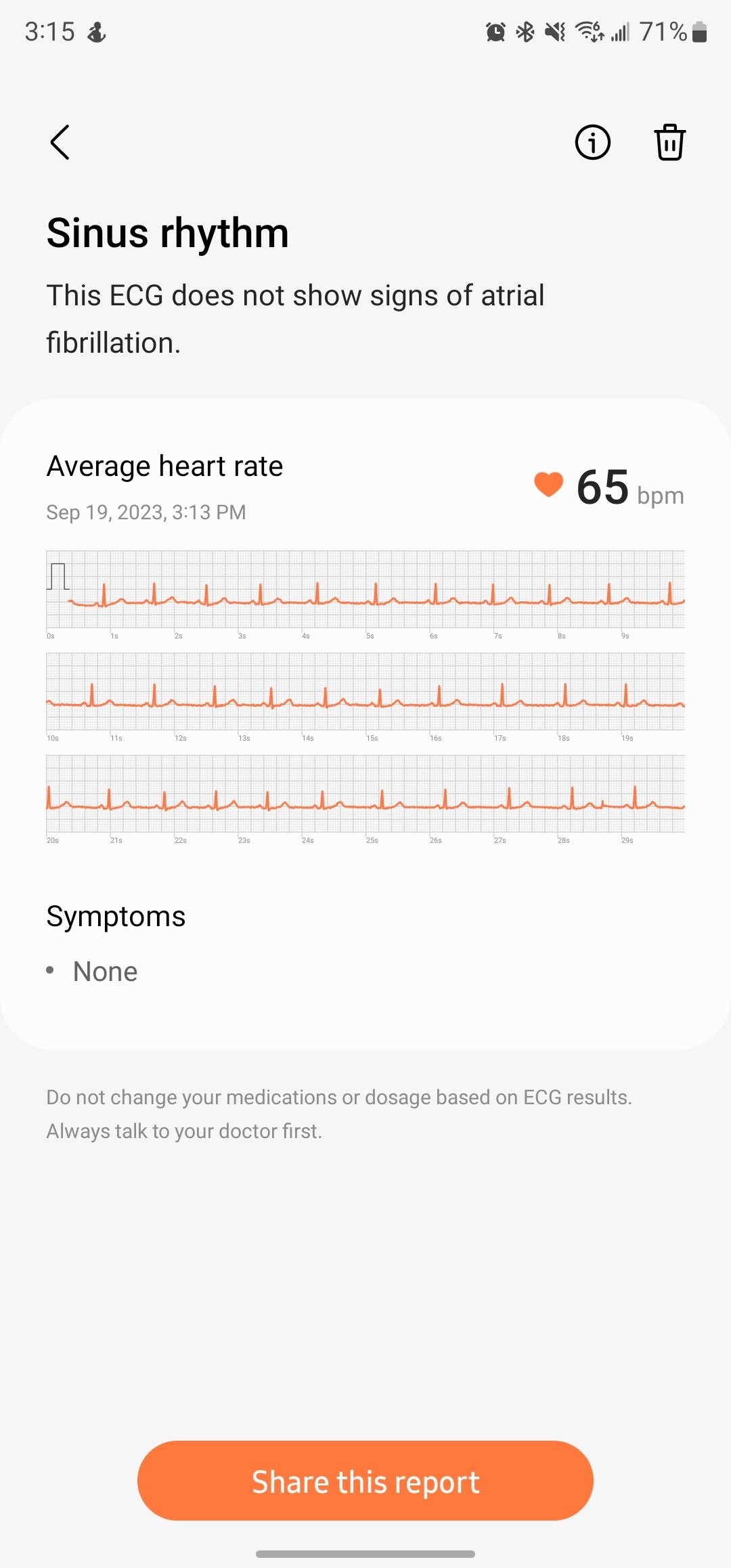 Detalhes do ECG no aplicativo móvel Samsung Health Monitor.