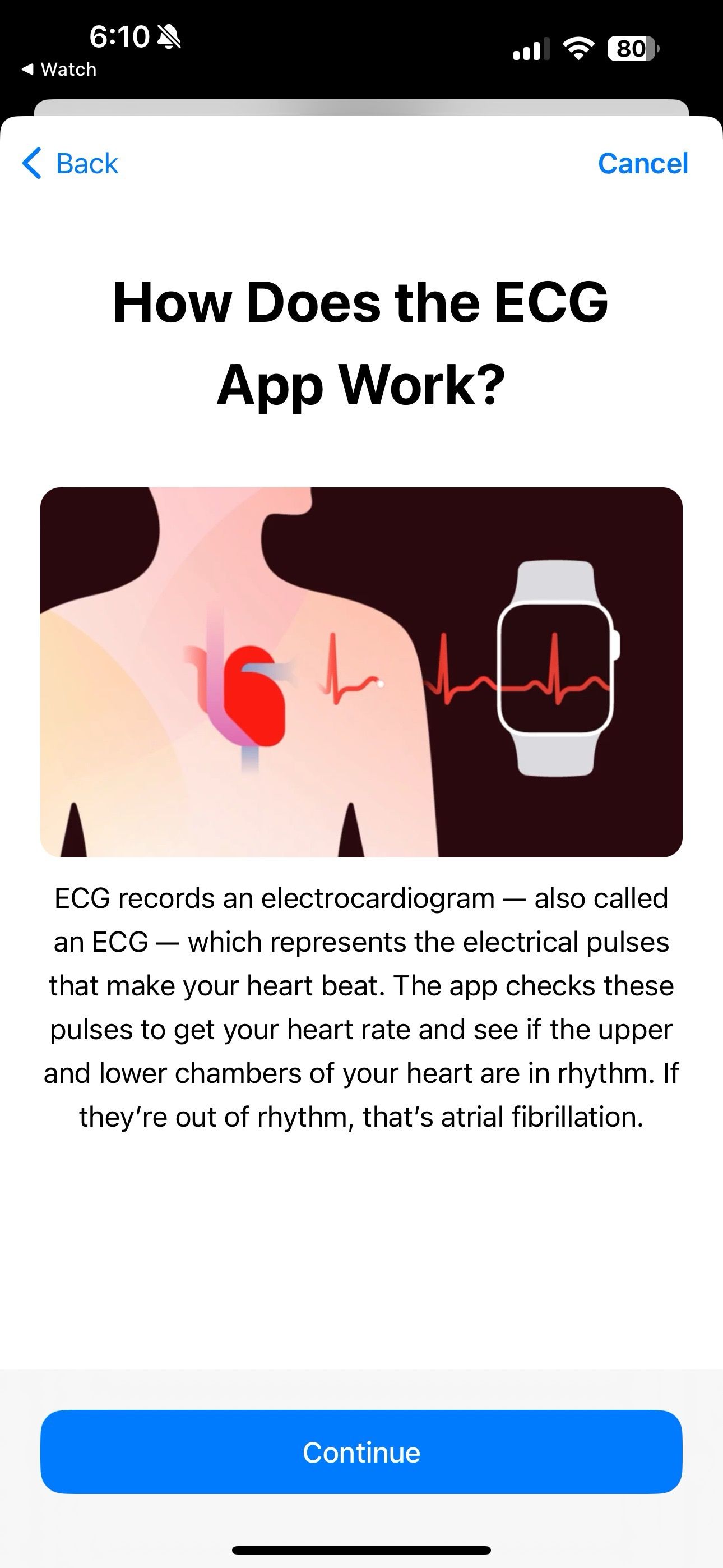 Detalhes de ECG no Apple Watch