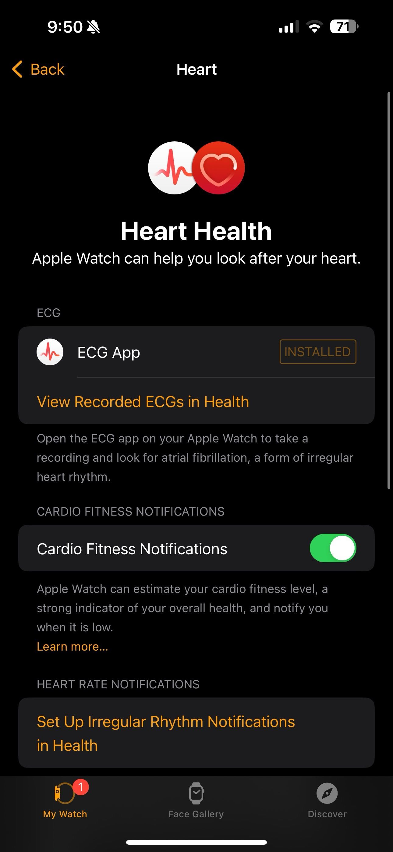 ECG instalado no Apple Watch